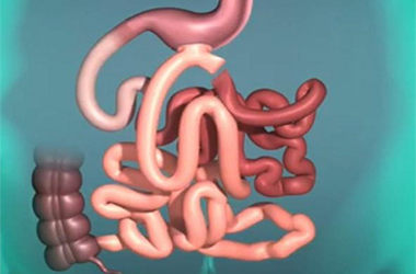 Técnica Bypass Gástrico